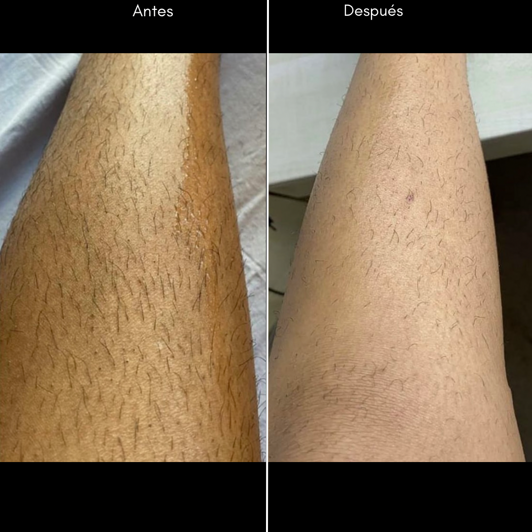 20240121_212518537_iOS