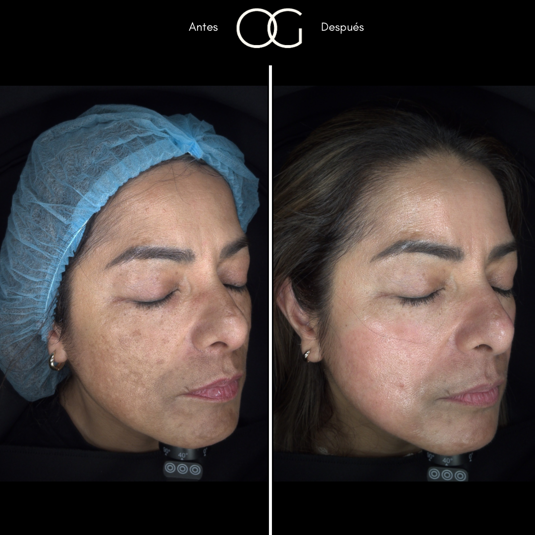 Copia de (copia conflictiva) ANTES 2