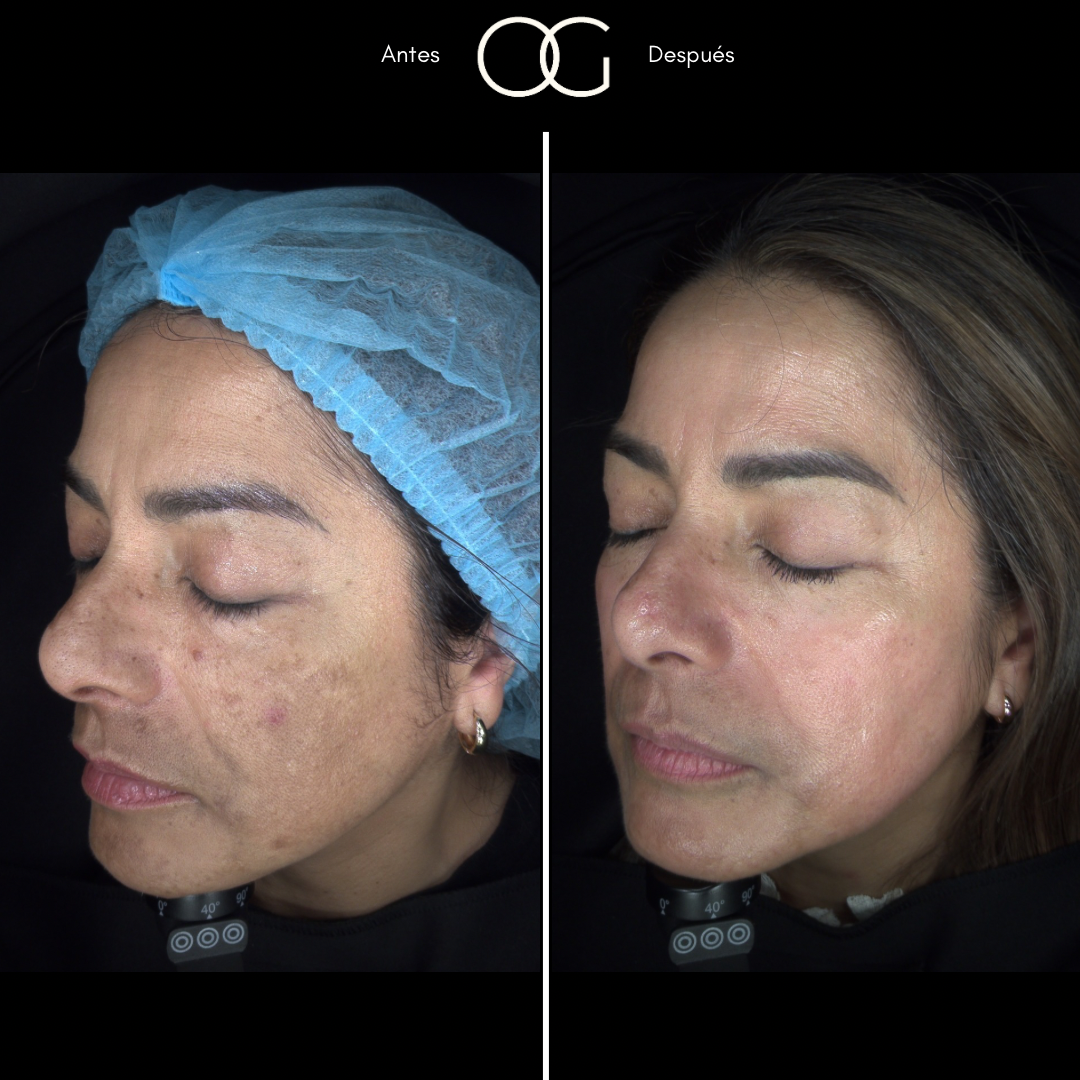 Copia de (copia conflictiva) ANTES 3