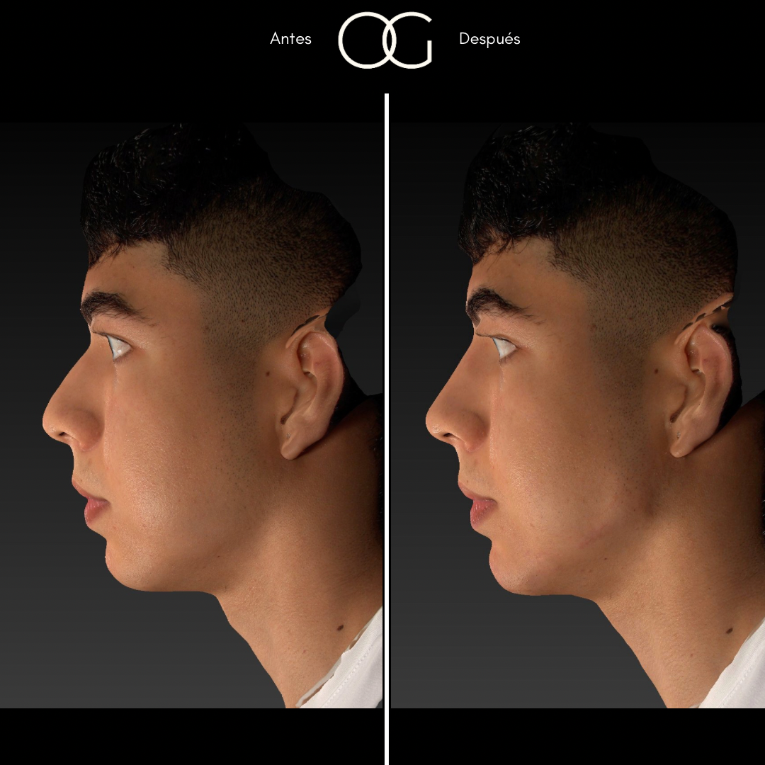 Copia de (copia conflictiva) ANTES 3