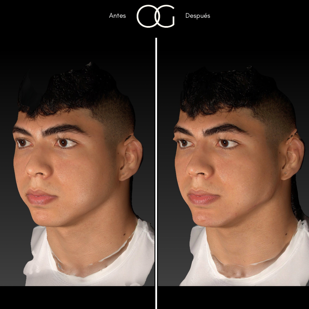 Copia de (copia conflictiva) ANTES 4