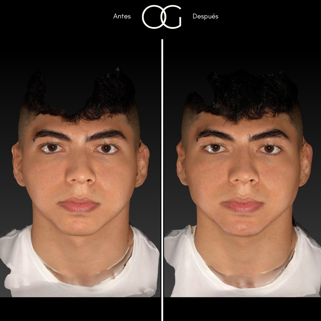 Copia de (copia conflictiva) ANTES 5