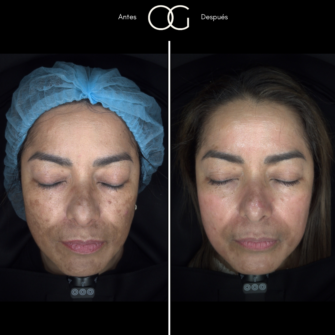 Copia de (copia conflictiva) ANTES